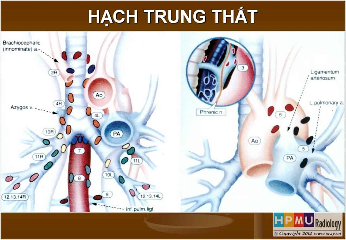 Hạch Trung Thất Bài giảng CĐHA