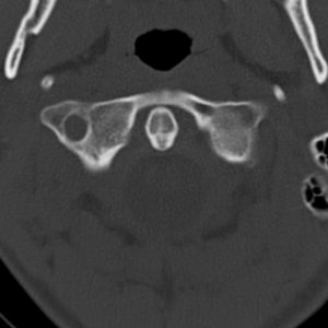 Dị dạng xương khớp