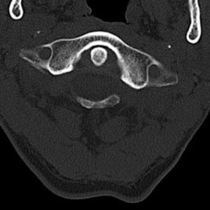 Dị dạng xương khớp