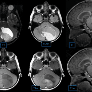 U tế bào hình sao
