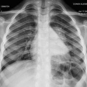 Case 1