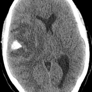 U TK đệm ít nhánh