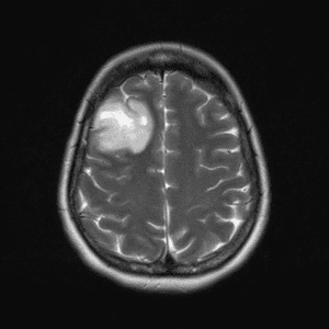 U TK đệm ít nhánh