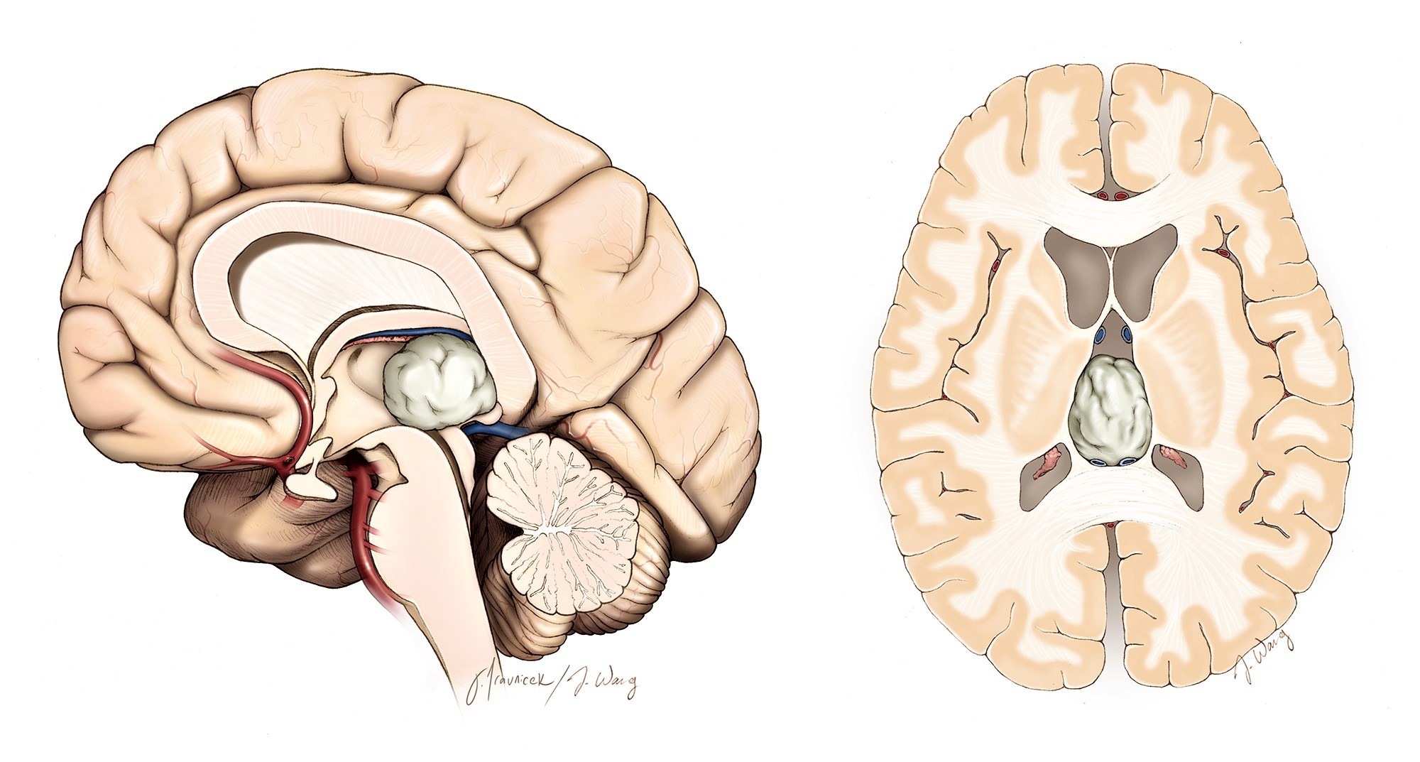 Ota-onalar bilan rus jinsiy aloqa Dushdagi porno video hd milf
