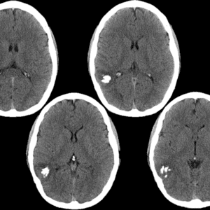 U TK đệm ít nhánh