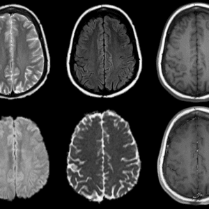 Lạc chỗ chất xám