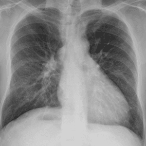 Đảo ngược phủ tạng