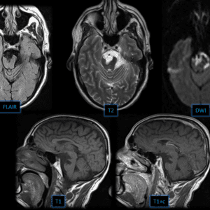 U nang thượng bì