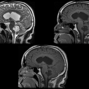 U nang thượng bì