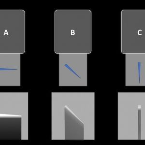 Dị vật phần mềm